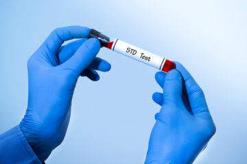 STD testing: How often should you be getting STI tests?