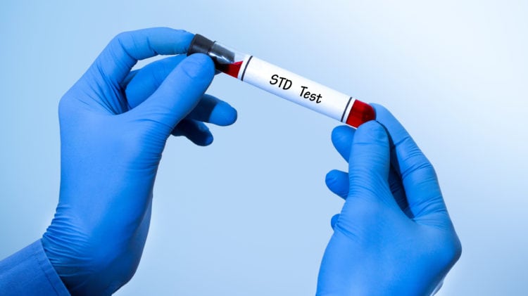 STD testing: How often should you be getting STI tests?